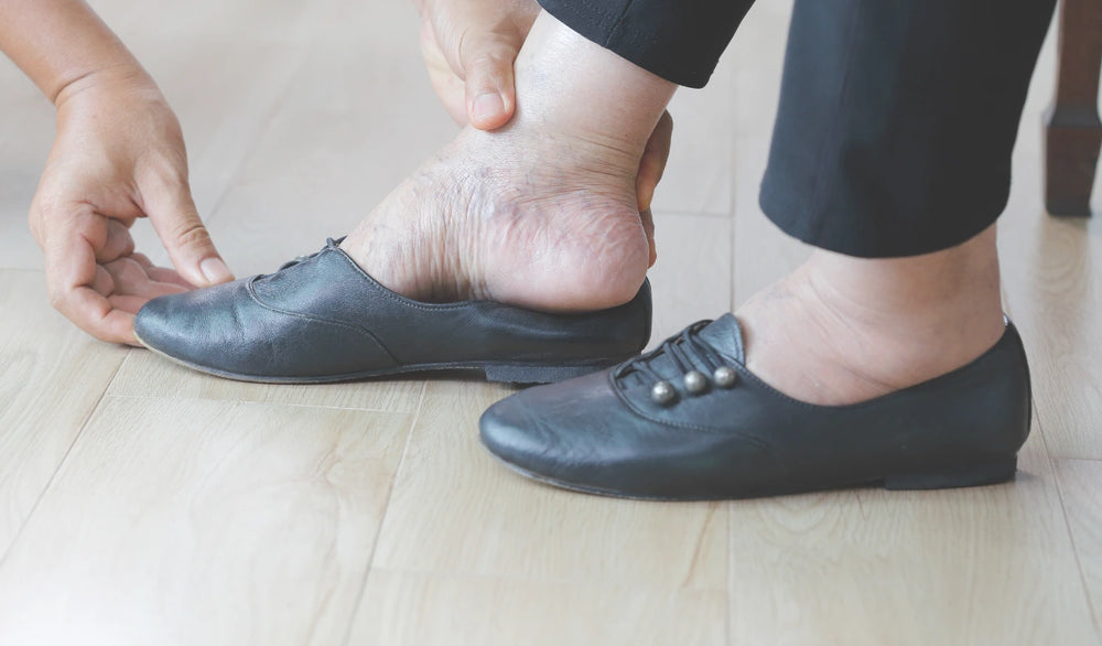 Pies inflamados en personas mayores: consejos y prevención